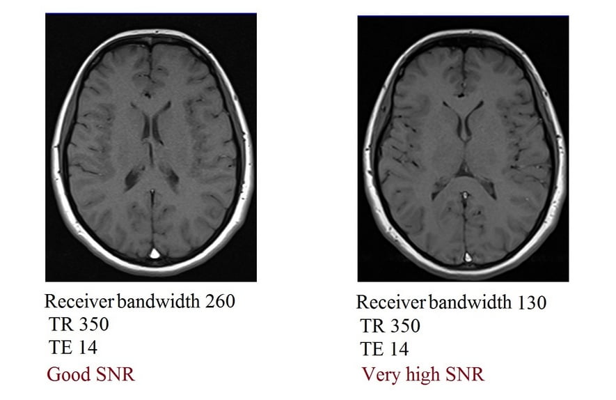 Bandwidt and SNR relation in MRI