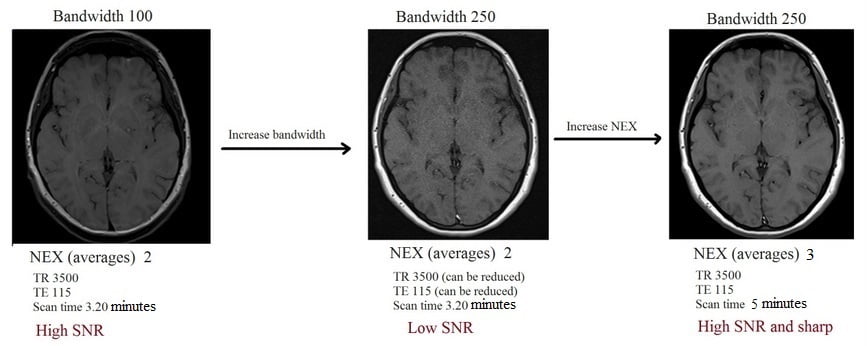 Bandwidth and NEX in MRI