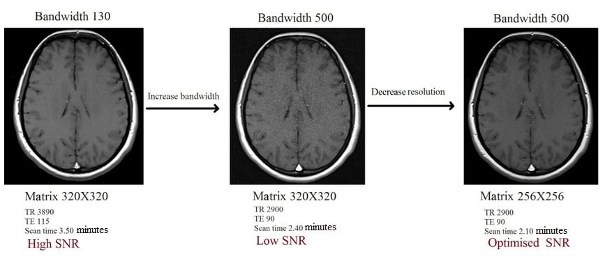 Bandwidth and Resolution in MRI