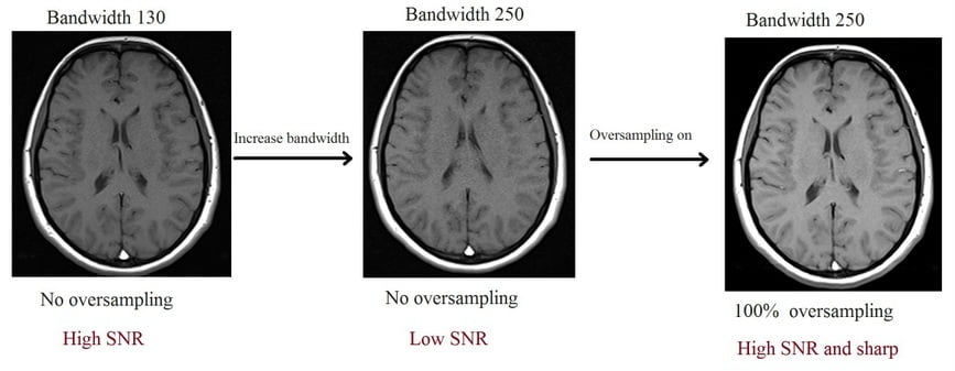 Bandwidth and oversamplaing in MRI