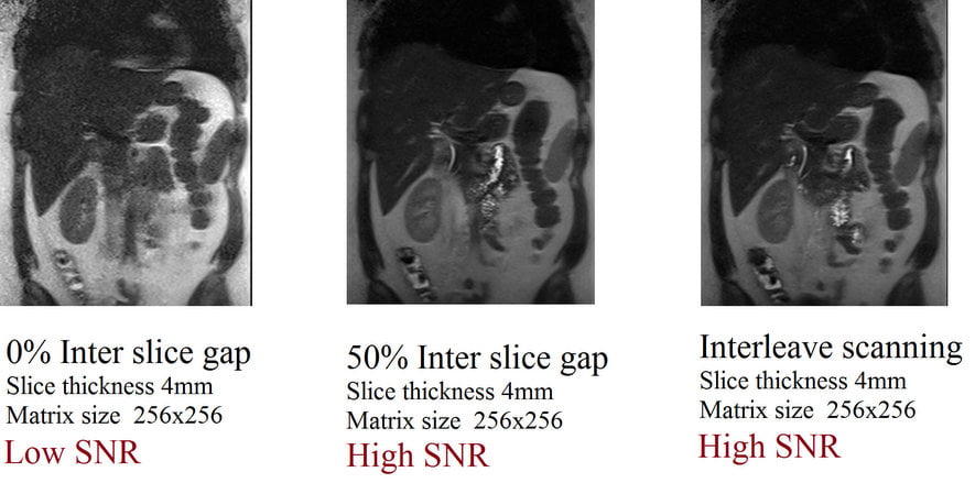 Inter slice gap and SNR relation in MRI