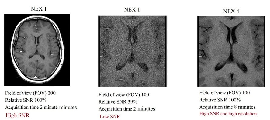 Relation between NEX, SNR and Field of view (FOV) in MRI