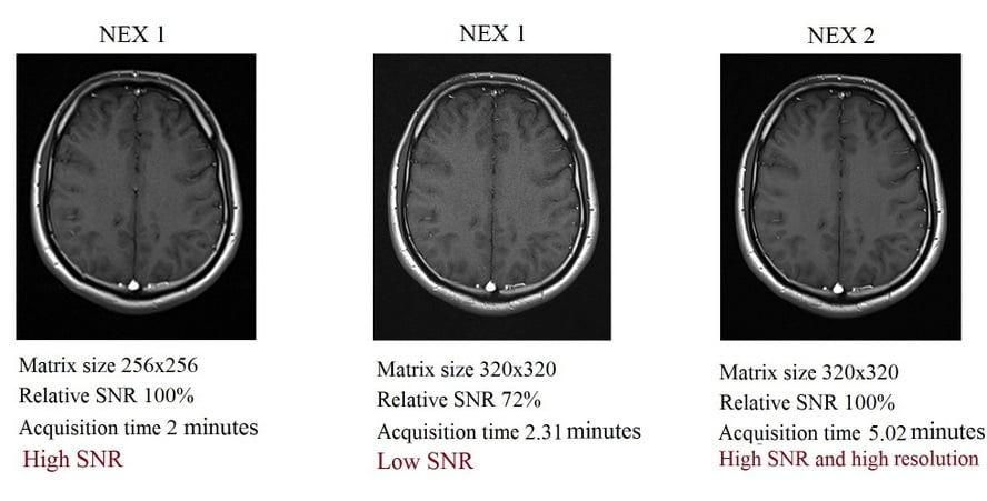 Relation between NEX, SNR and resolution (matrix size) in MRI