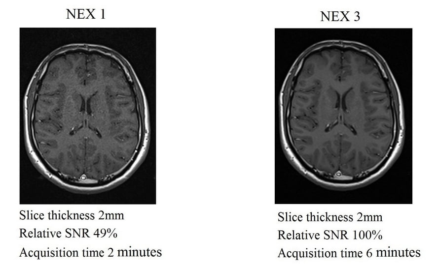 Relation between NEX, SNR and slice thickness in MRI