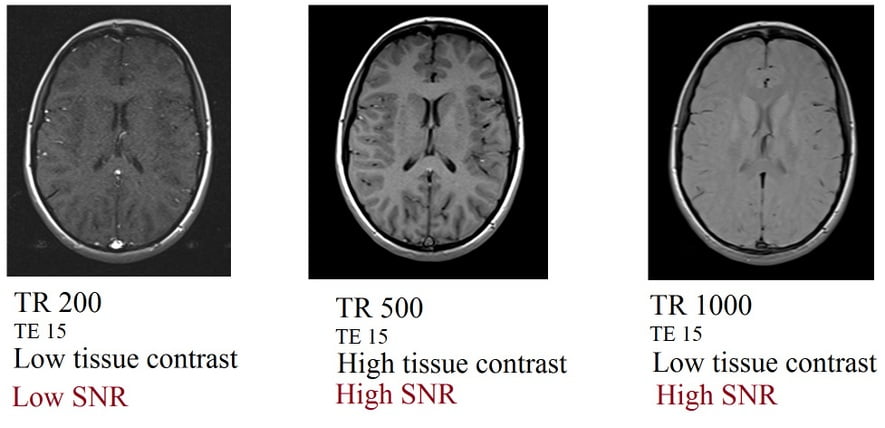 Repetition time (TR) and SNR relation in MRI