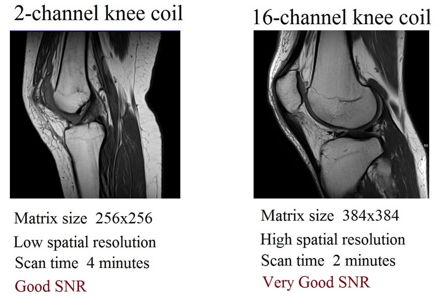 SNR comparison of low channel (coil elements) and high channel (coil elements) MRI coils