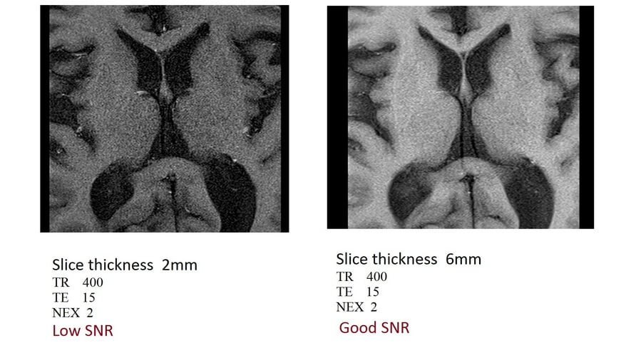 Slice thickness and SNR relation in MRI