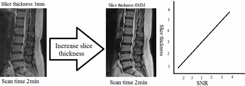 How to manipulate a High resolution grainy image by increasing Increase slices thickness