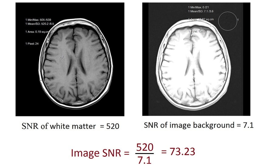 How to calculate SNR of an image IN MRI