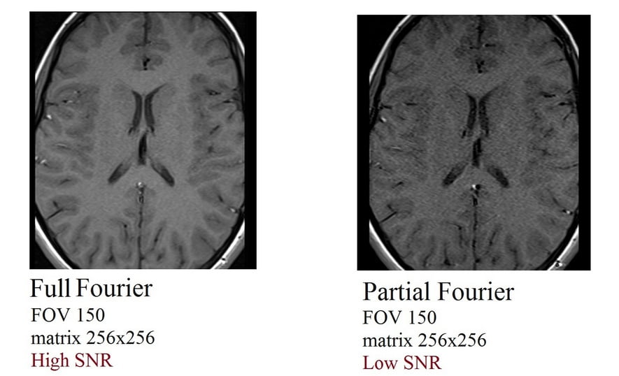 partial Fourier (Partial K- space filling) and SNR relation in MRI