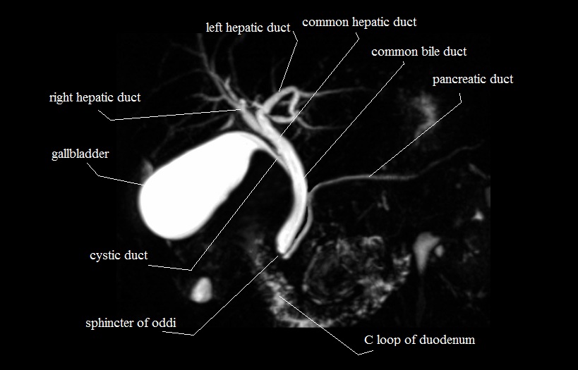 Biliary system anatomy (MRCP anatomy )