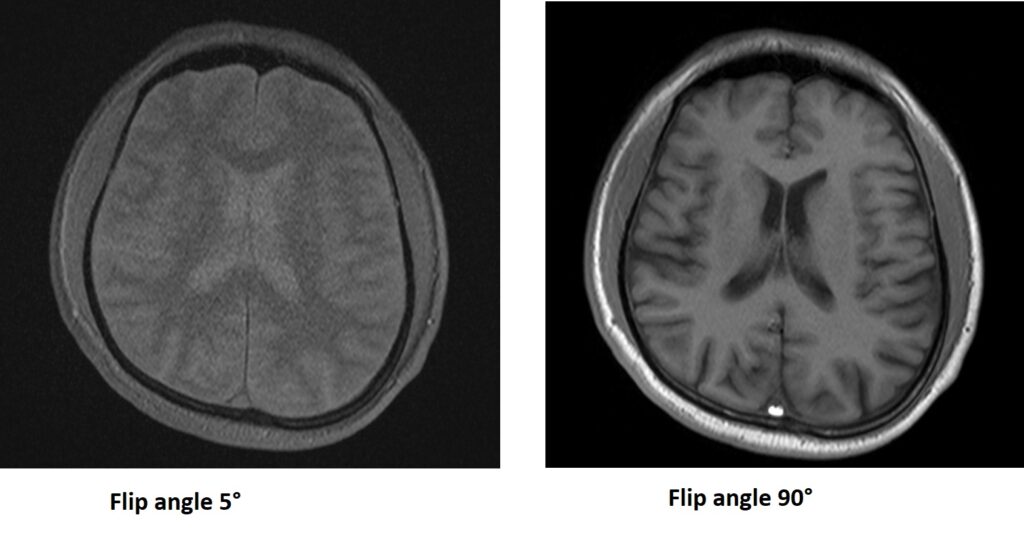 Flip angle and SNR