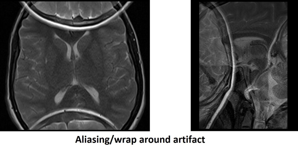 Aliasing/wrap around artifact