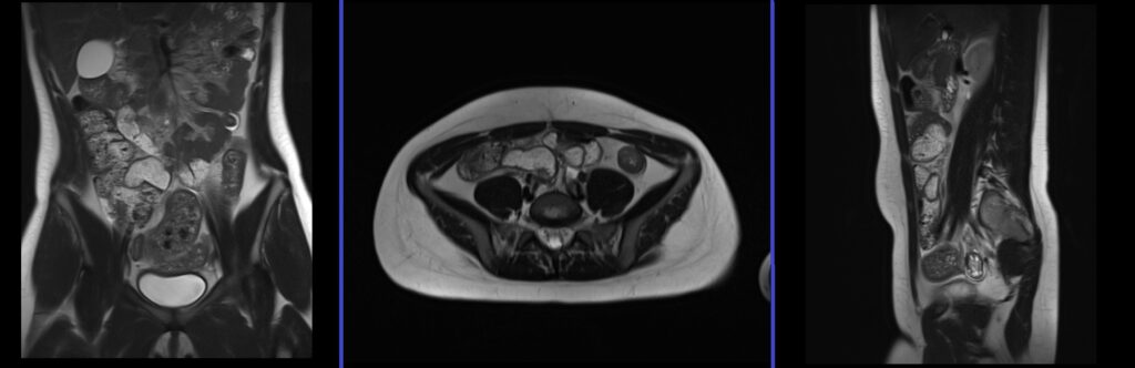 Appendix mri planning and protocol localiser image