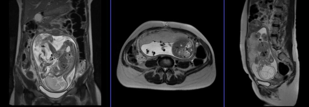 Fetal MRI planning and protocol haste localiser