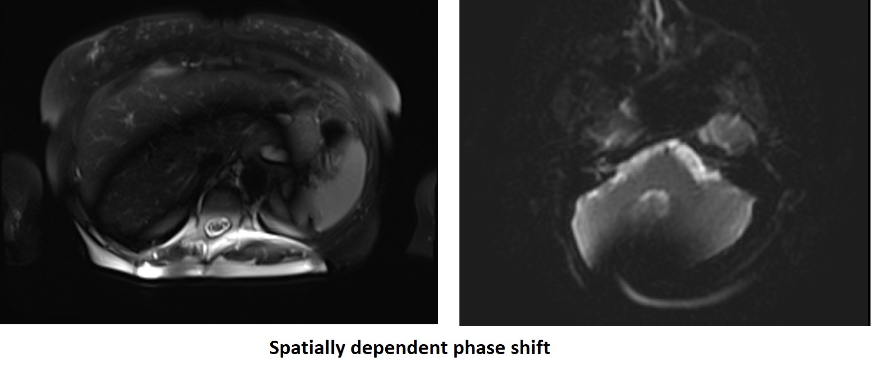 Spatially dependent phase shift