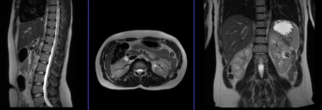 mra renal angiogram localiser image