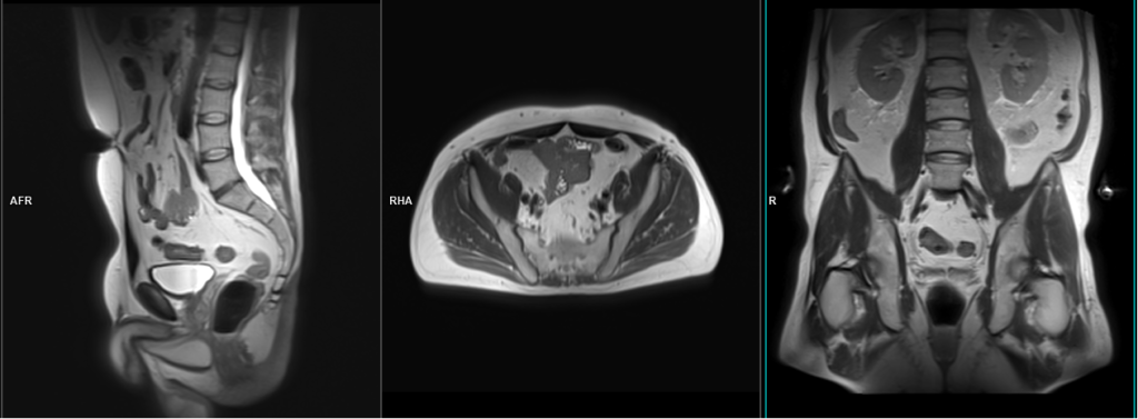 MRI prostate protocol and planning localiser image