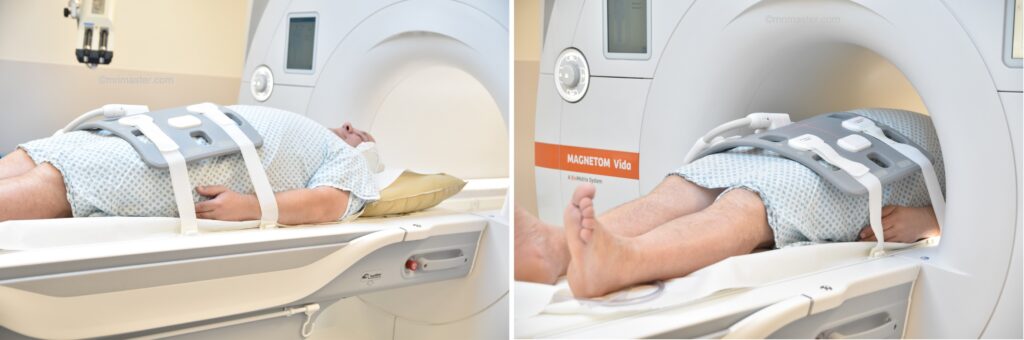 MRI urinary bladder positioning photo