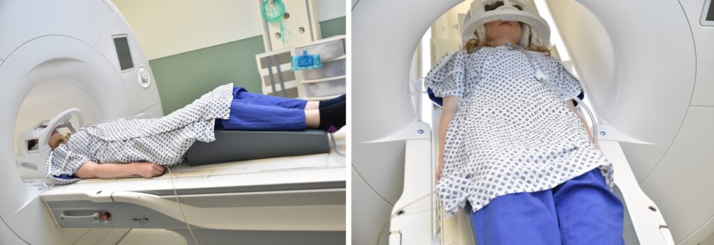 MRI whole spine positioning photo