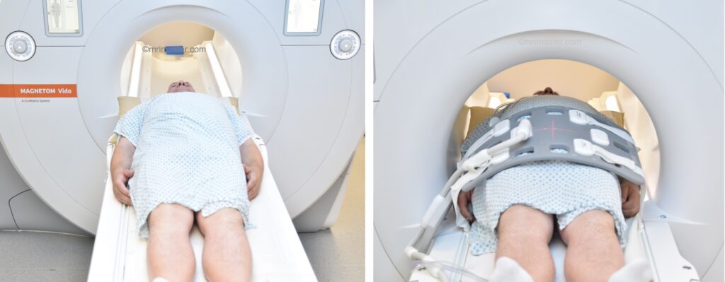 PENILE MRI positioning photo