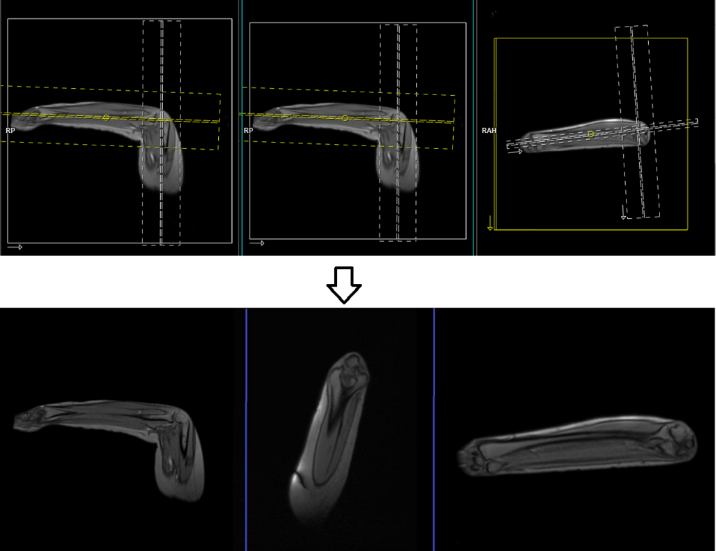 MRI FABS View localiser planning image