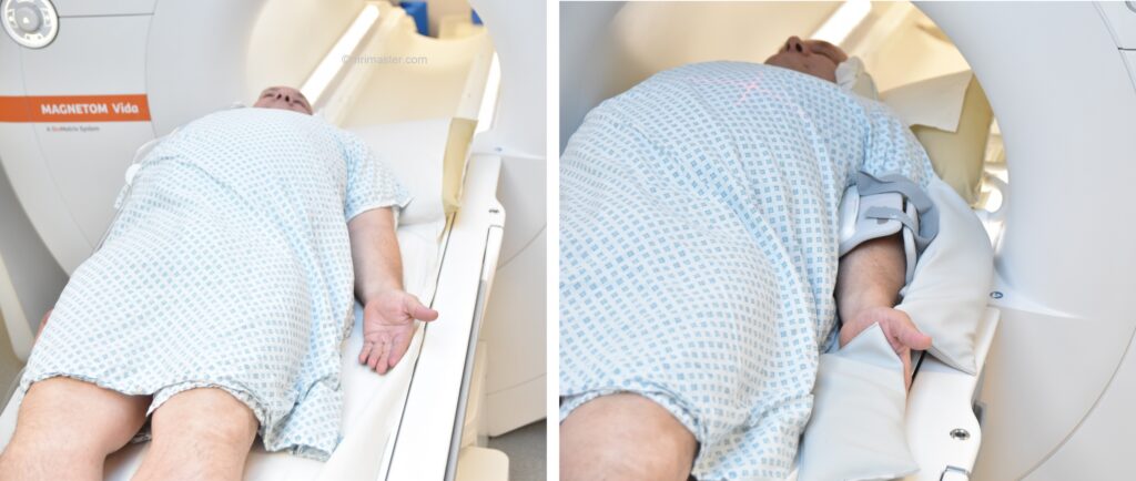 MRI elbow positioning photo