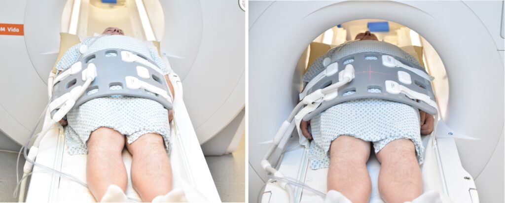 MRI hip arthrogram positioning photo