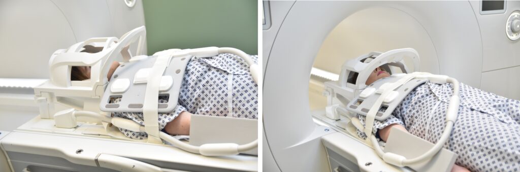 Thymus (mediastinum) mri positioning photo