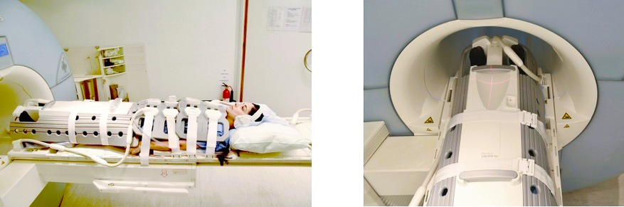 qiss(non-contrast) mra lower limb MRI positioning photo