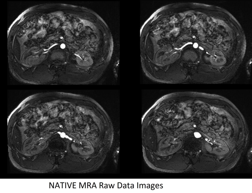 NATIVE MRA Raw Data Images