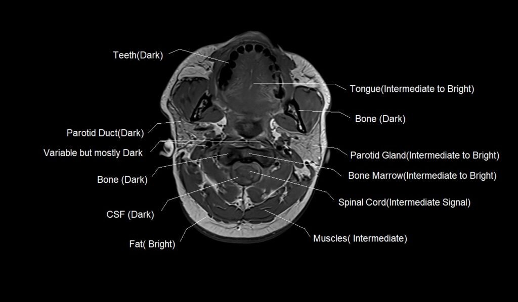 T1 MRI appearance of various tissues in the face