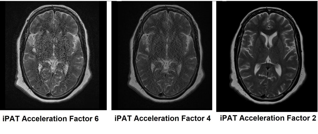starry-sky artifact MRI how to reduce