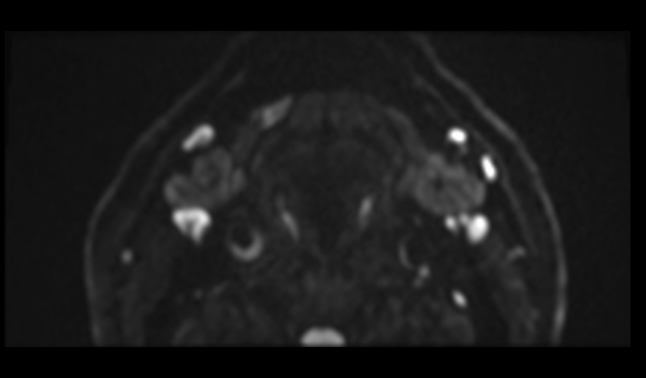 ZOOMit-DWI b800 image of neck