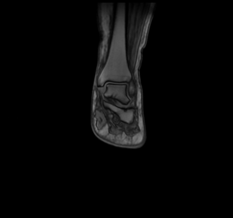 Ankle localiser image 1