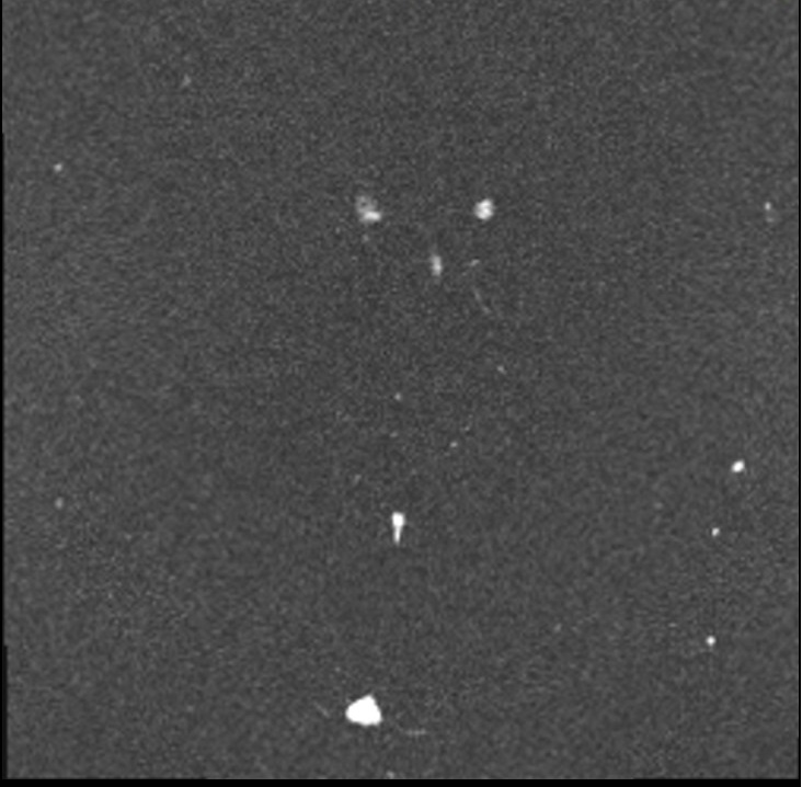 Magnitude Image of Phase-contrast (PC) sequence used in CSF flow imaging