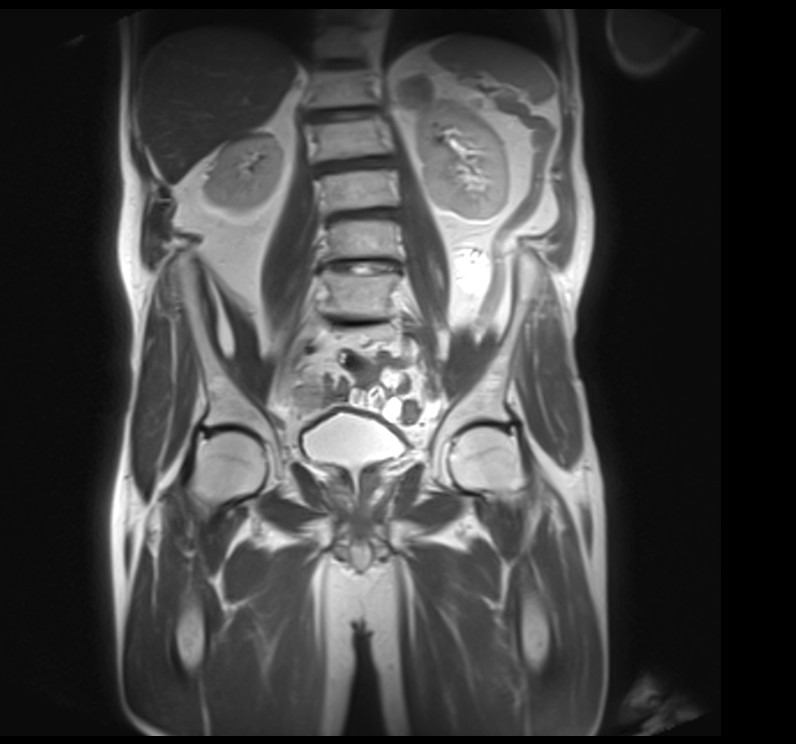 Pelvis t2 localiser image 2