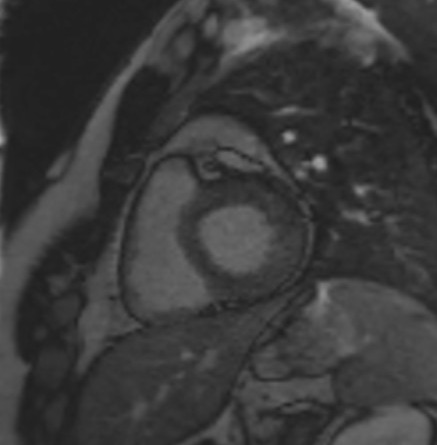 TI scout (look-locker) MRI with TI 300