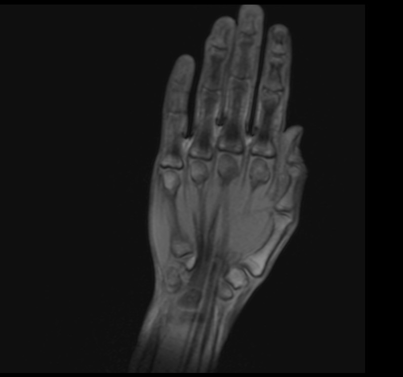hand t1 localiser image 2