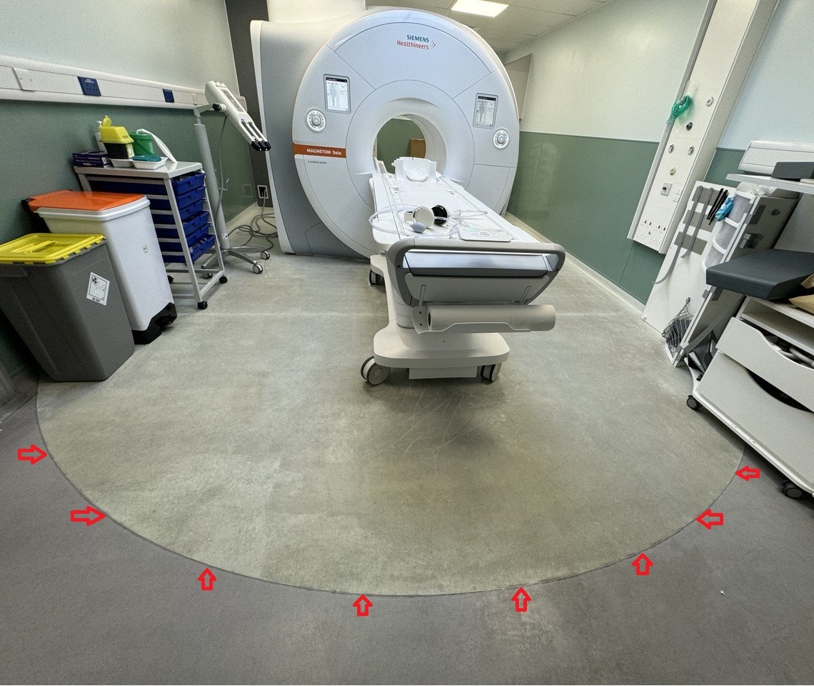 5 gaus line in mri