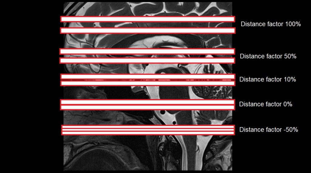 Distance factor in MRI