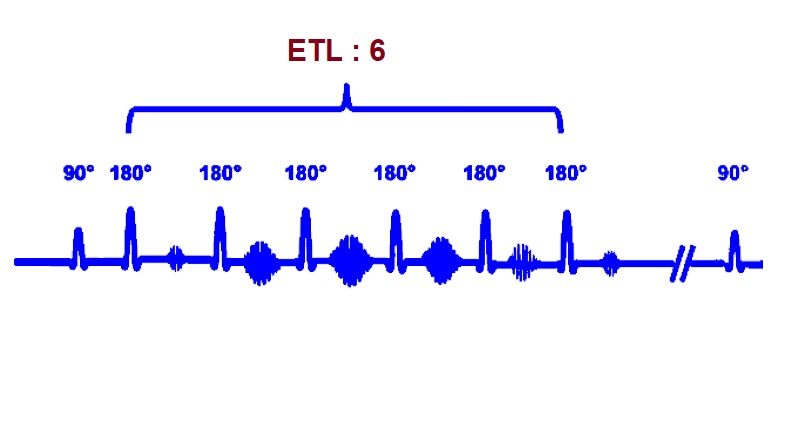 echo train length diagram