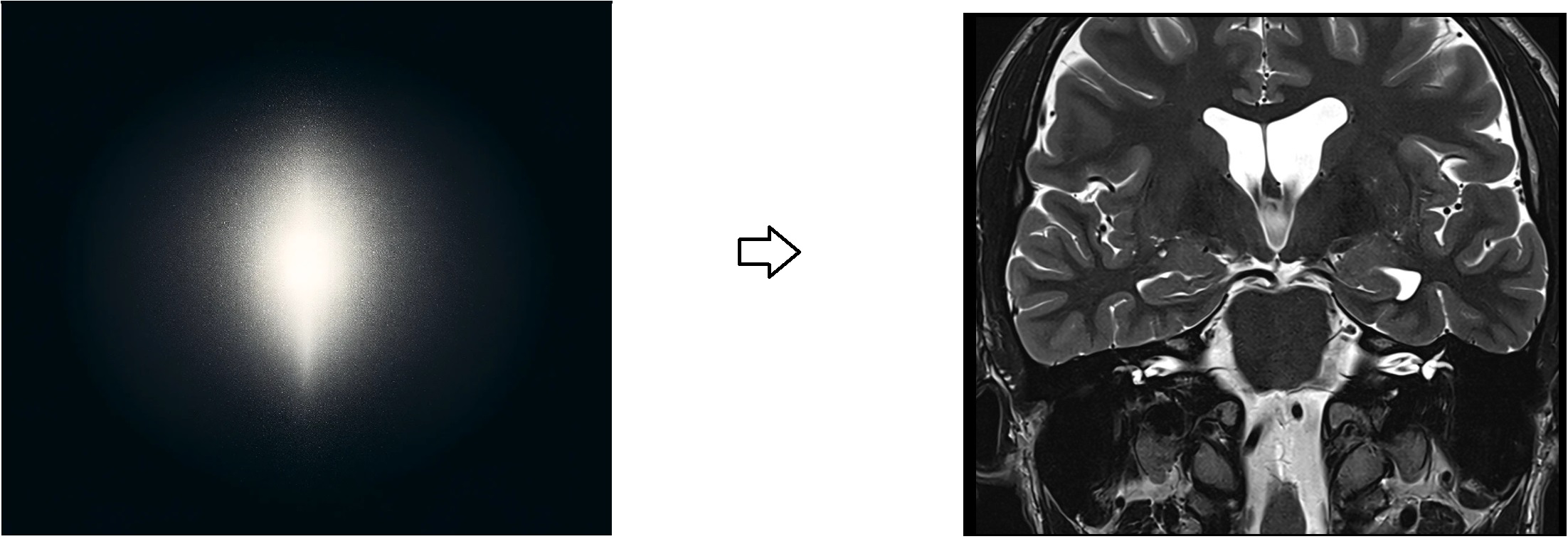 K- space MRI image