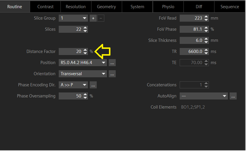 distance factor in Siemens MRI scanner