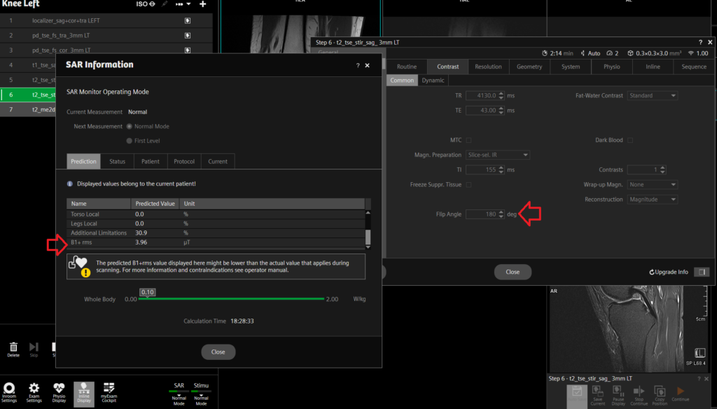 B1+rms and flip angle Relationship 1