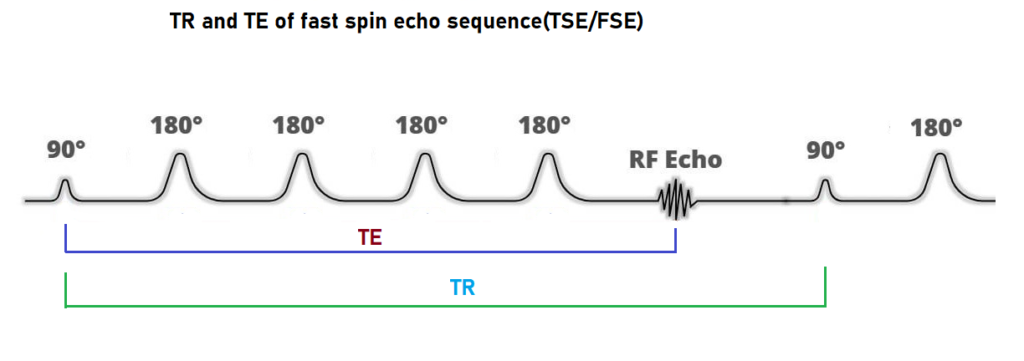 TR and TE of Fat spin echo(TSE) sequence