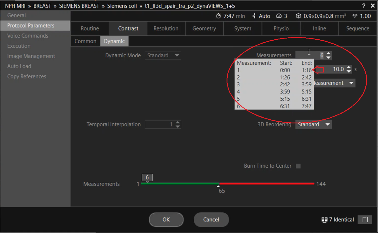 Temporal resolution in MRI