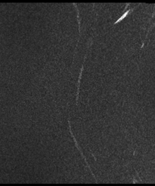 CSF Flow Magnitude Image Cervical Spine Image CSF Flow Magnitude Image Cervical Spine Image