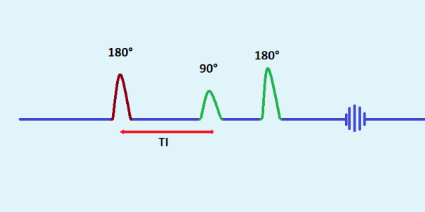 Inversion Time (TI) in MRI physics demonstration Inversion Time (TI) in MRI physics demonstration