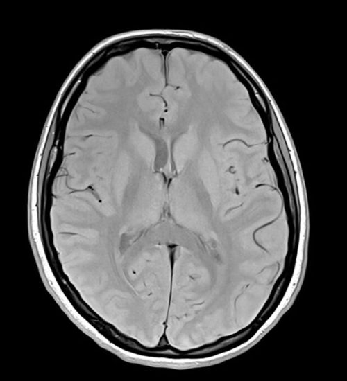 PD Axial sequence used in brain imaging PD Axial sequence